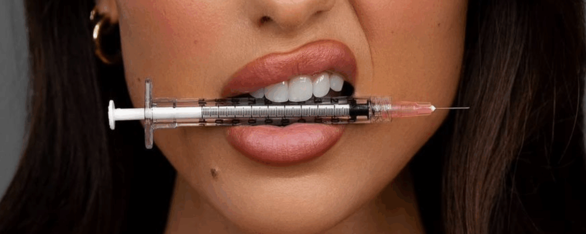 Natural lip filler results South Easton MA
